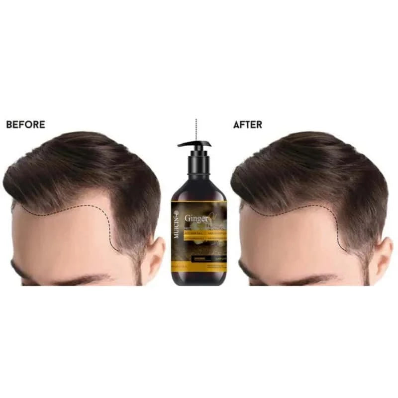 Ginger Oil Anti-Hair Fall Shampoo