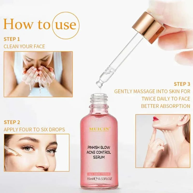 V9 Pinkish Glow Anti Acne Face Serum