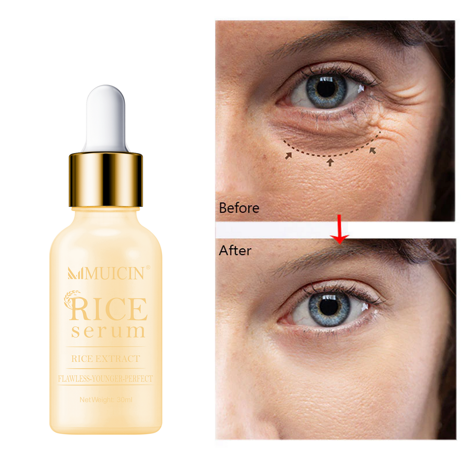RICE SERUM FOR FAIRER &amp; FLAWLESS SKIN - EVEN TONE PERFECTION