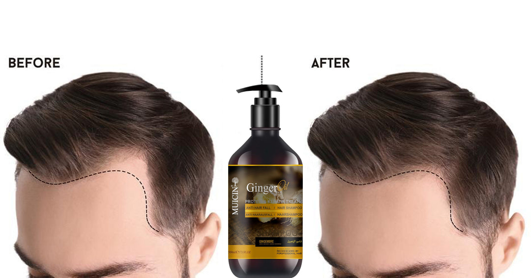 MUICIN - Ginger Oil Anti Hair Fall Shampoo - 500ml Best Price in Pakistan